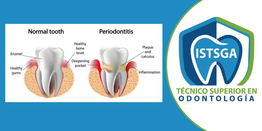 Periodoncia_AS_24