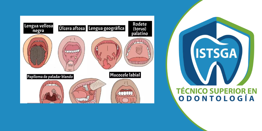 Patología dental_AS_24