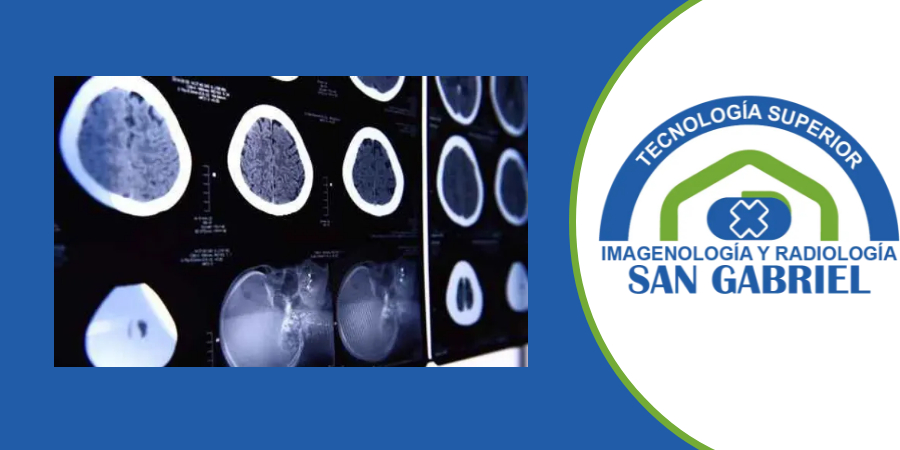 Técnicas Tomográficas I_OM_26